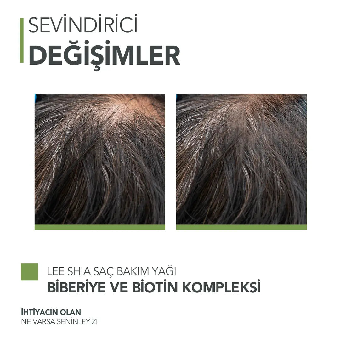 Biberiye ve Biotin Kompleks 50 ml