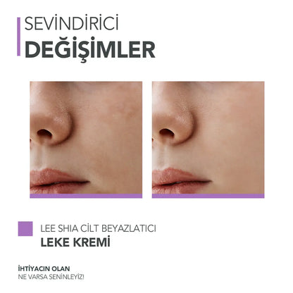 Cilt Beyazlatıcı Leke Kremi 100 ml