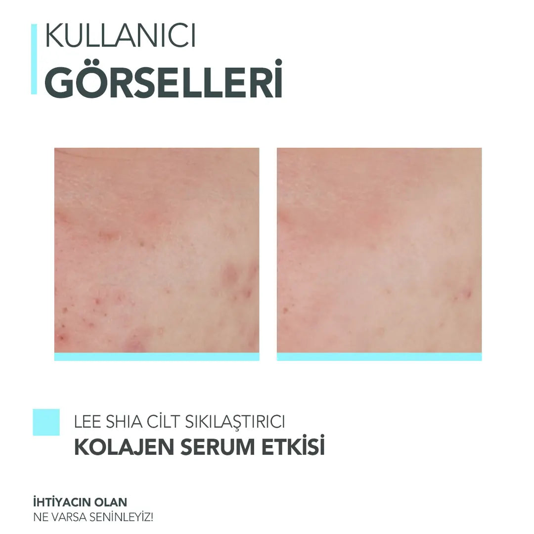 Cilt Sıkılaştırıcı Kolajen Serum 30ml