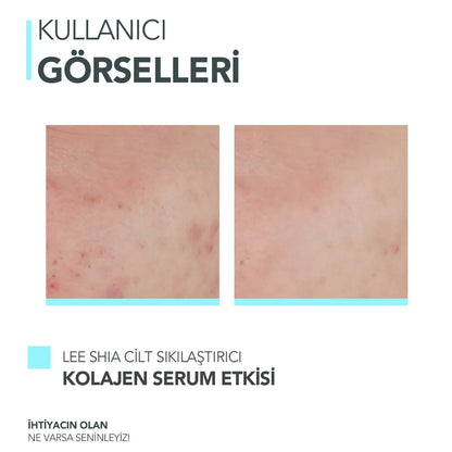 Cilt Sıkılaştırıcı Kolajen Serum 30ml